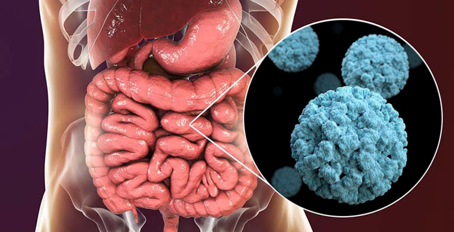 norovirus