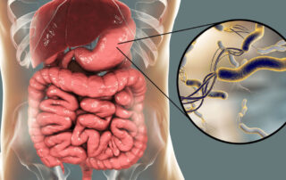 sve o helikobakteriji