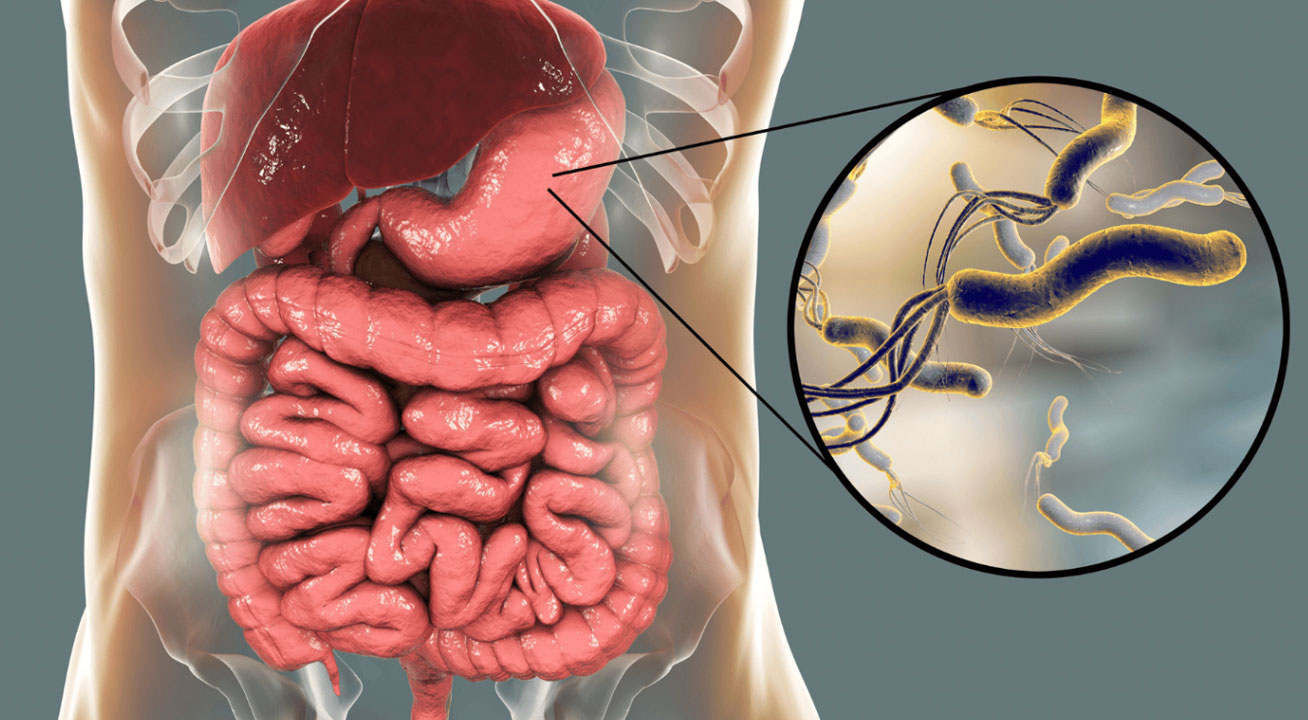 sve o helikobakteriji