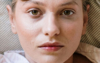 tamni kolutovi oko očiju