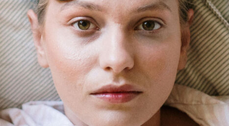 Tamni podočnjaci i kolutovi oko očiju – uzroci i rešenja