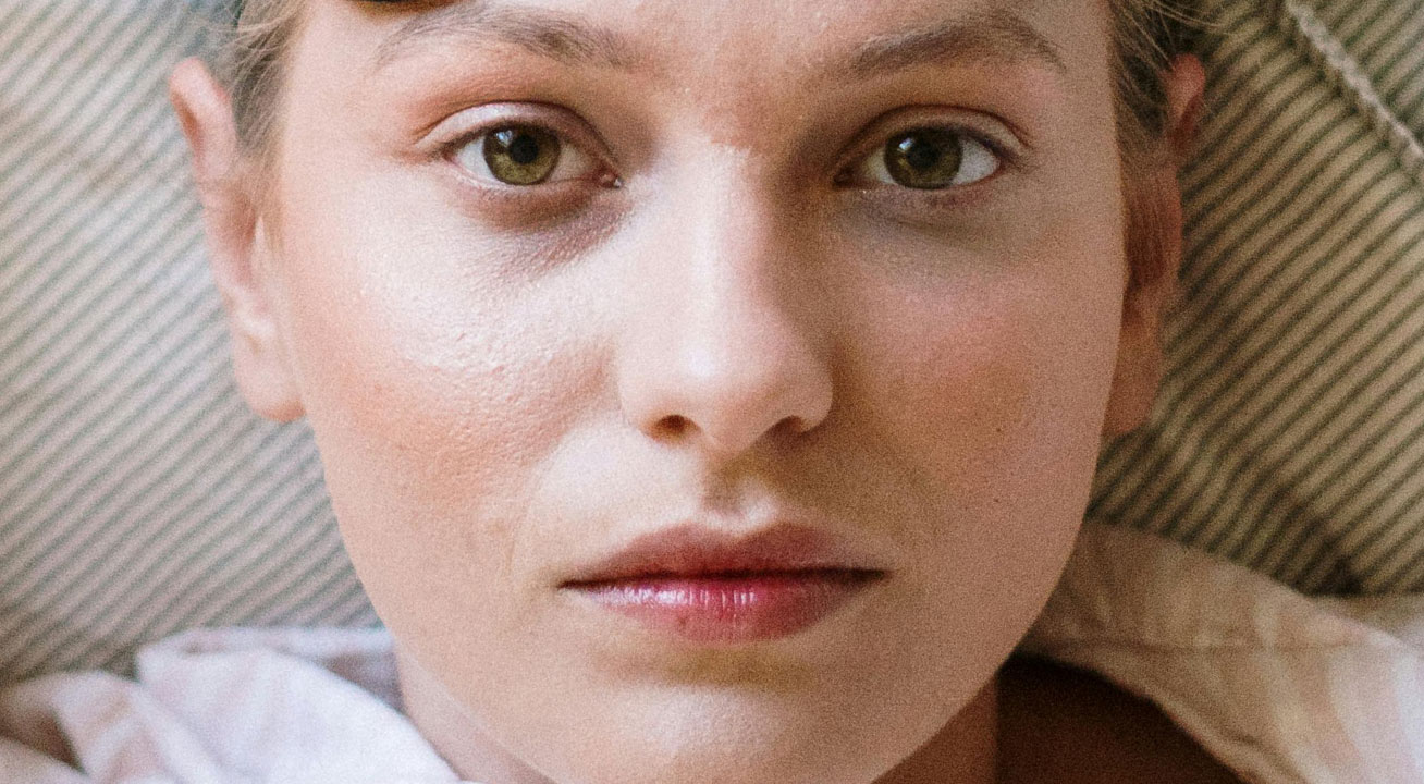 tamni kolutovi oko očiju